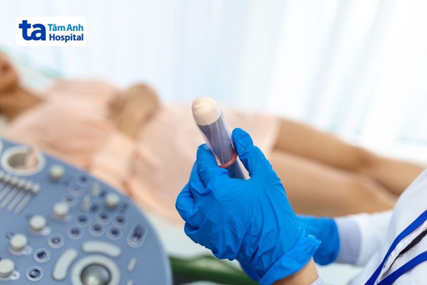 kiểm tra cấu trúc của các cơ quan sinh sản