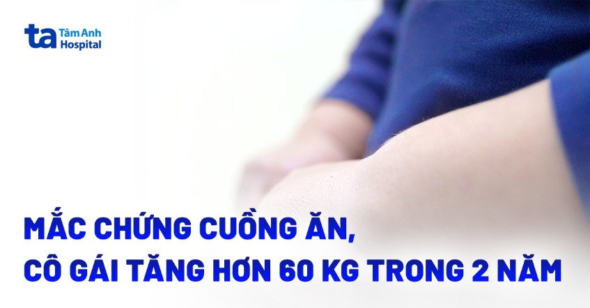 mắc chứng cuồn ăn tăng 60kg trong 2 năm