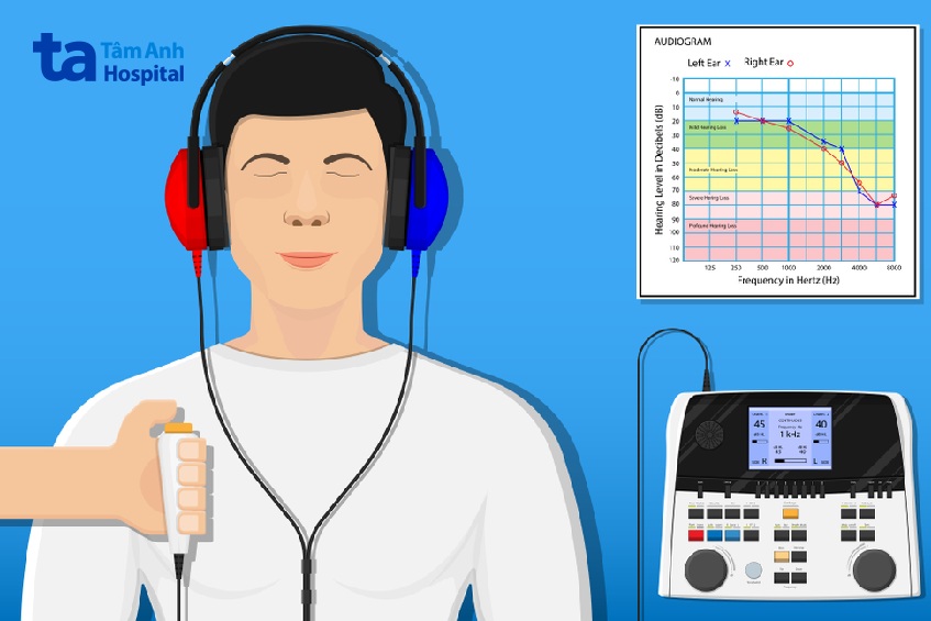 Phương pháp điều trị mất thính lực
