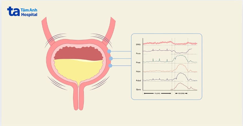 mô hình đo niệu động học