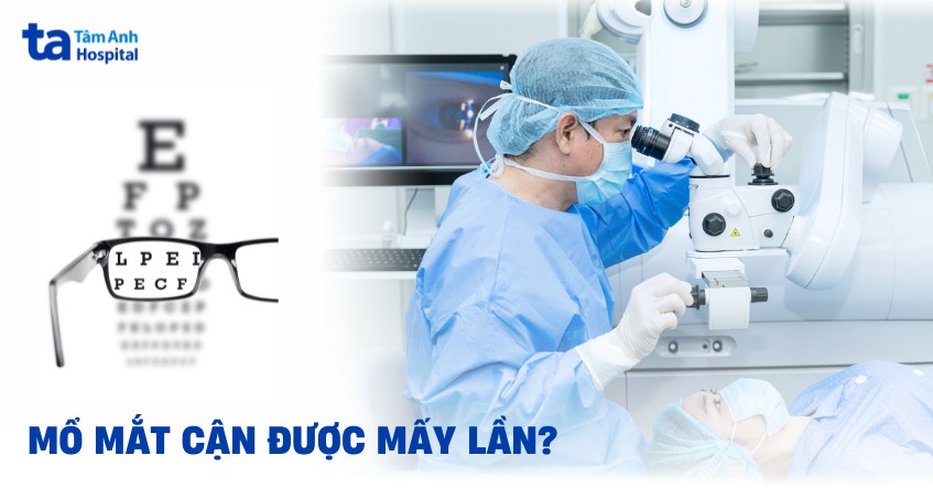 Có thể mổ mắt cận được mấy lần? Hiệu quả, điều kiện và lưu ý
