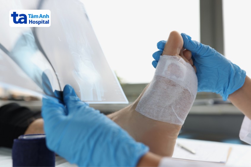 người bệnh hạt tophi cần điều trị theo bác sĩ