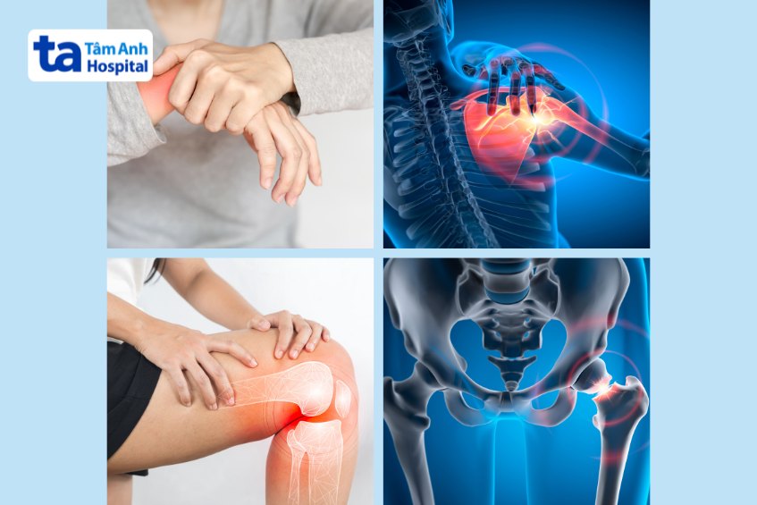 người trẻ có thể bị đau nhức xương khớp