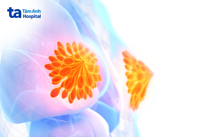 nguyên nhân gây đau nhói như kim châm ở vú