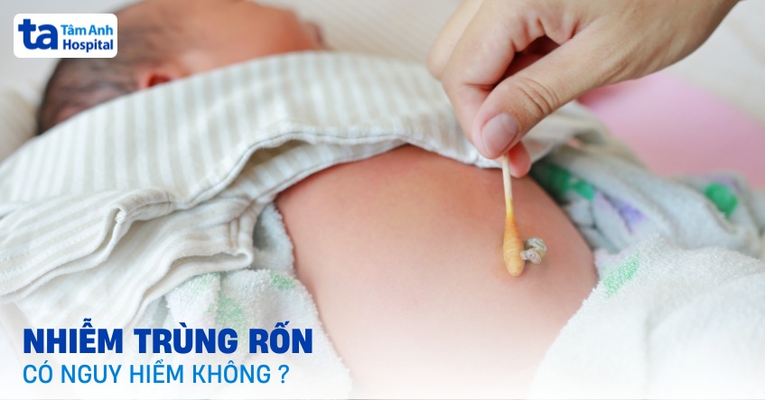 Nhiễm trùng rốn có nguy hiểm không? [Chuyên gia giải đáp]