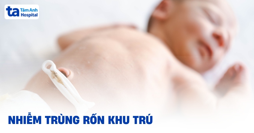 Nhiễm trùng rốn khu trú: Nguyên nhân, triệu chứng, cách điều trị