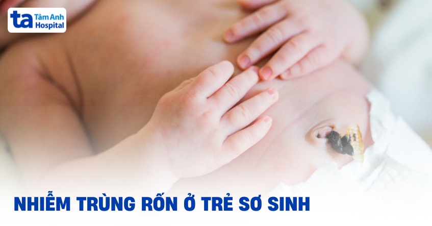 Nhiễm trùng rốn ở trẻ sơ sinh: Nguyên nhân, dấu hiệu và chẩn đoán