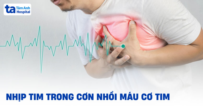 Nhịp tim trong cơn nhồi máu cơ tim có biểu hiện như thế nào?