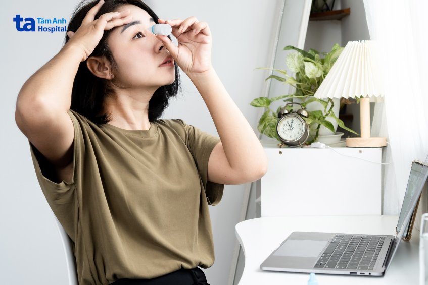 nhỏ thuốc theo hướng dẫn sau mổ smile pro