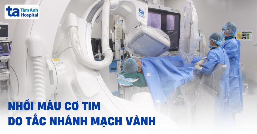 Nhồi máu cơ tim do tắc hoàn toàn nhánh mạch vành