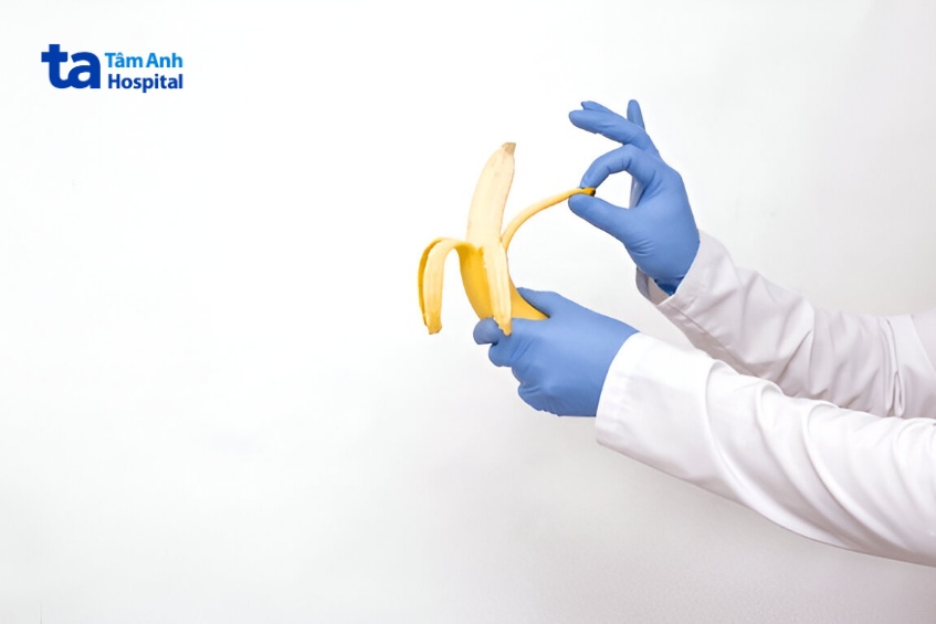 những lưu ý cần biết khi lột bao quy đầu tại nhà