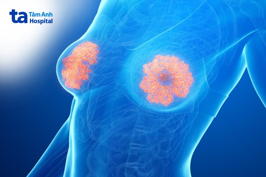 núm vú bị sưng và đau kéo dài bao lâu cần phải đi khám