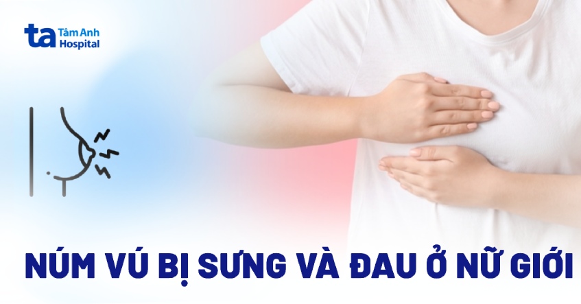 Núm vú bị sưng và đau ở nữ nguyên nhân do đâu? Nguy hiểm không?