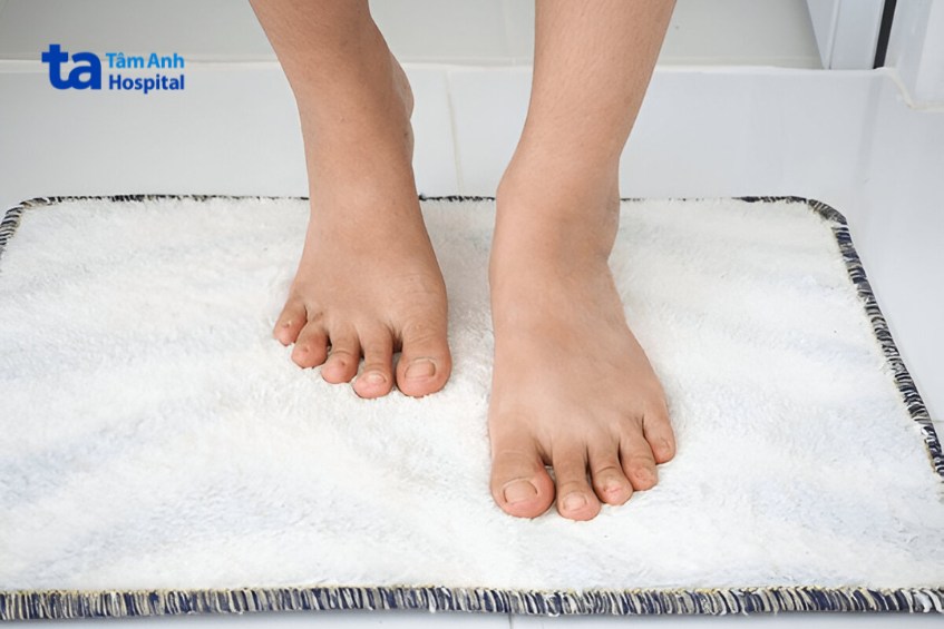 nướng dẫn chăm sóc móng chân sau điều trị hạn chế tái phát
