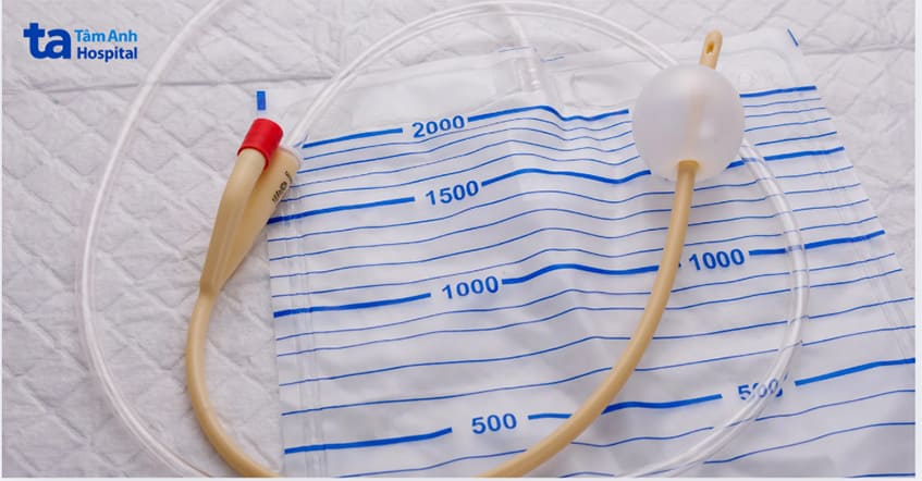 ống thông tiểu được dùng để điều trị bí tiểu ở người già