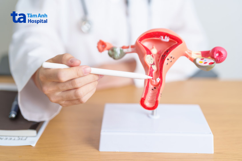 phác đồ điều trị phụ thuộc vào tình trạng của tử cung