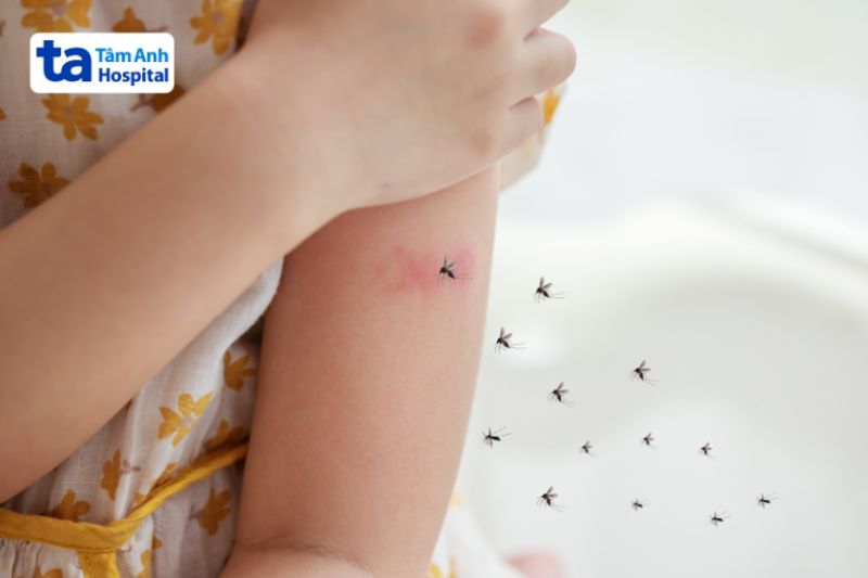 sốt xuất huyết do virus Dengue gây ra