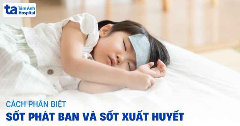 8 cách phân biệt sốt phát ban và sốt xuất huyết cần tham khảo