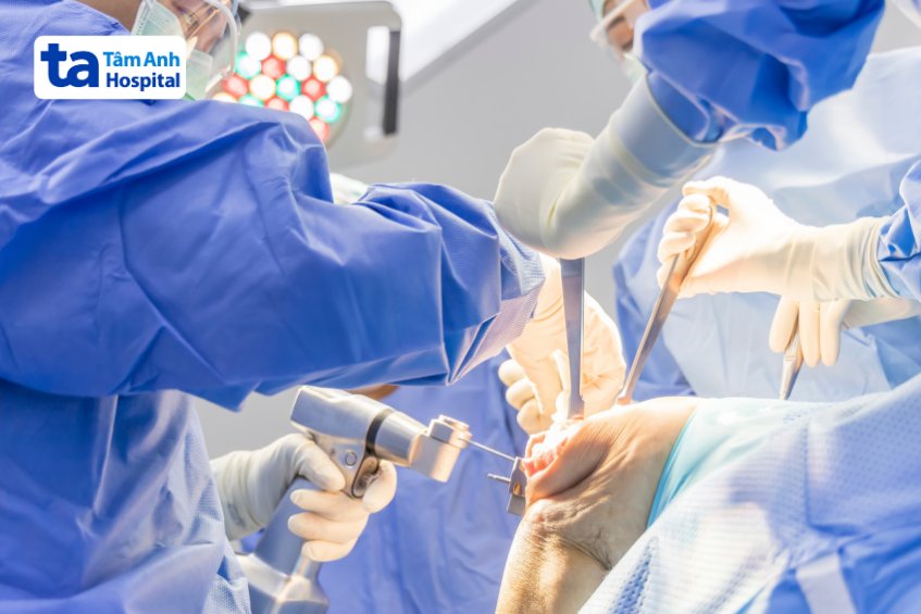 phẫu thuật điều trị paget xương