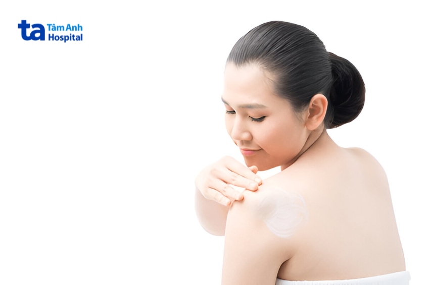 phòng ngừa vảy nến đảo ngược