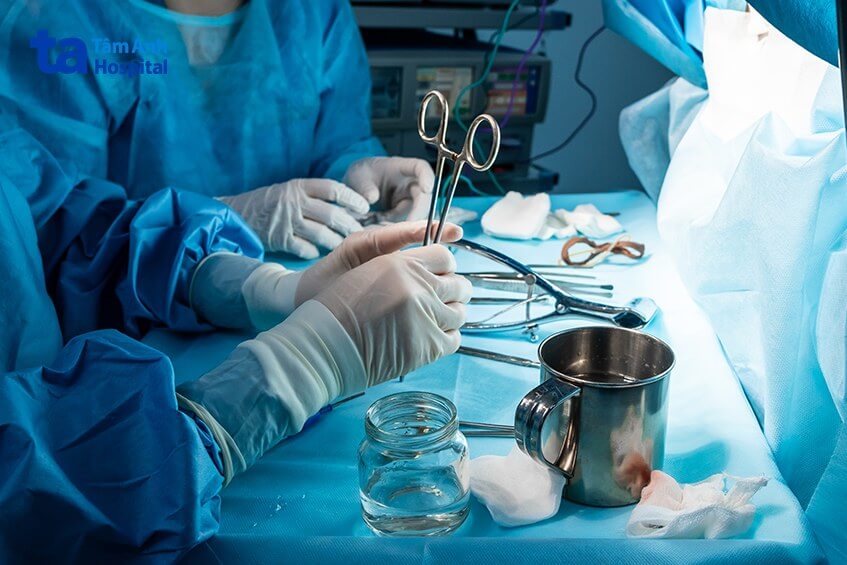 phương pháp cắt trĩ hcpt