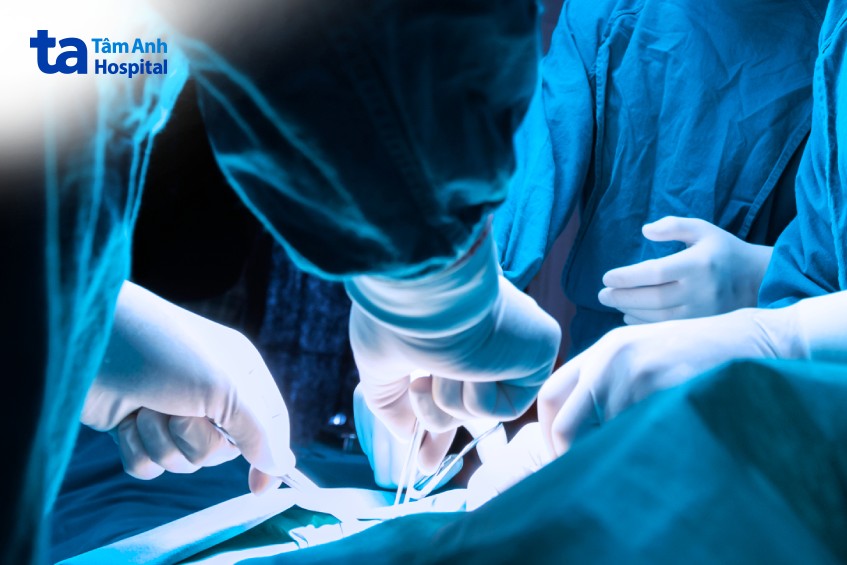 phương pháp phẫu thuật ung thư đại tràng