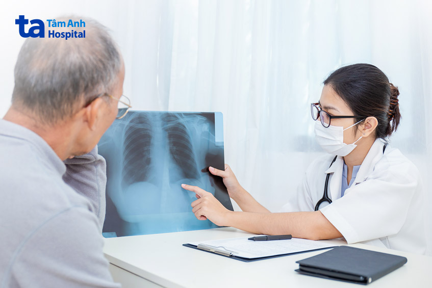 phương pháp sàng lọc chẩn đoán bệnh xơ phổi