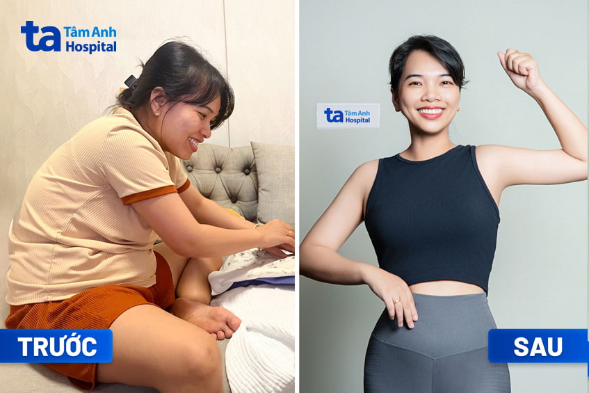 Chị Ngô Trần Thanh Thảo trước và sau giảm cân