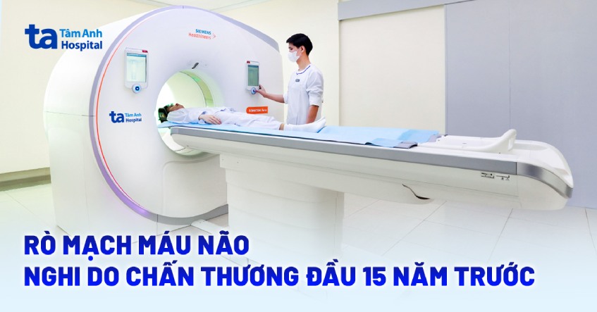 Rò mạch máu não nghi do chấn thương đầu 15 năm trước