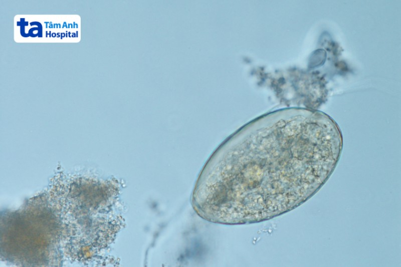 ảnh trứng sán lá ruột