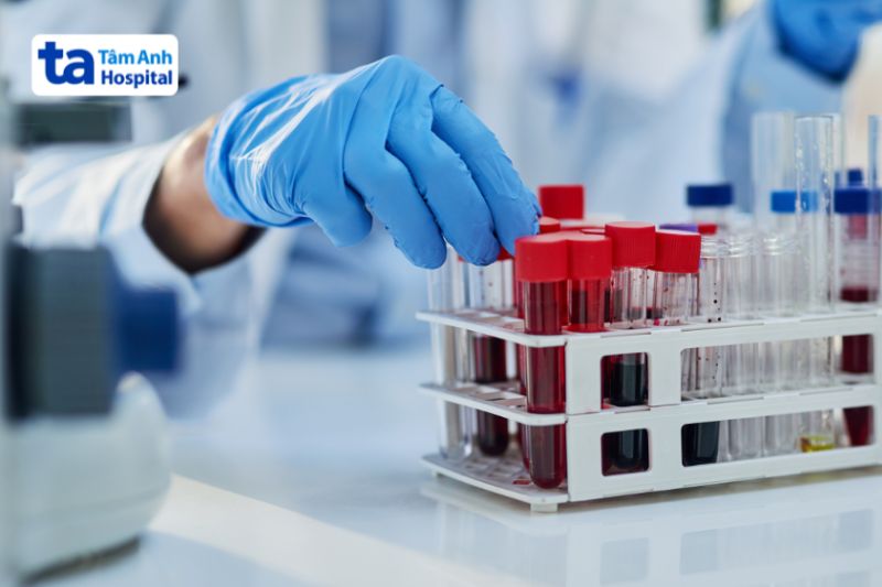 xét nghiệm máu chẩn đoán sán máng