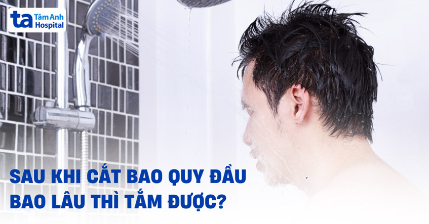 Sau khi cắt bao quy đầu bao lâu thì tắm được? Kiêng cữ mấy ngày?