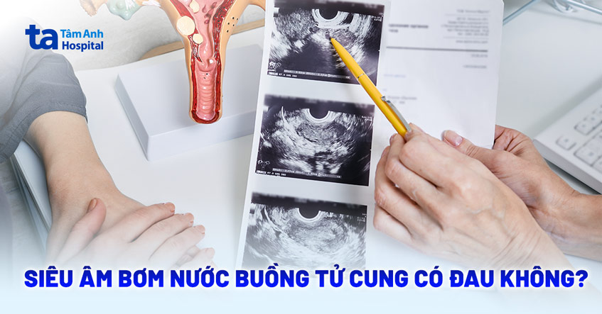 Siêu âm bơm nước buồng tử cung có đau không? Kéo dài bao lâu?
