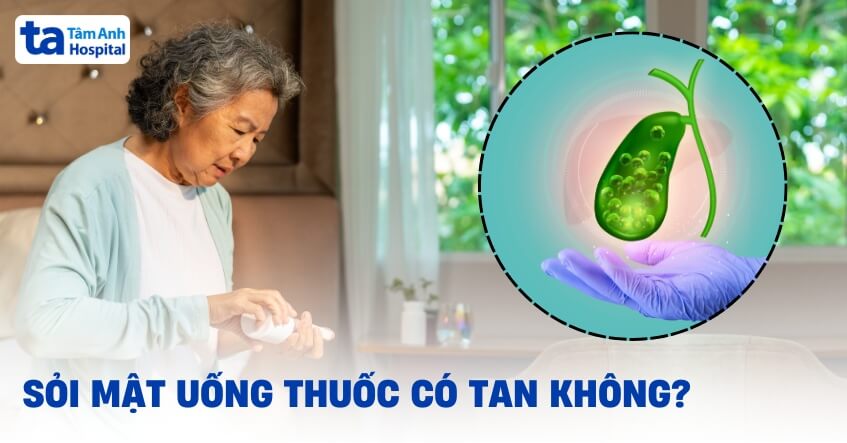 Sỏi mật uống thuốc có tan không? Ưu, nhược điểm khi dùng