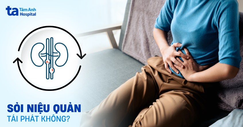 sỏi niệu quản có tái phát không