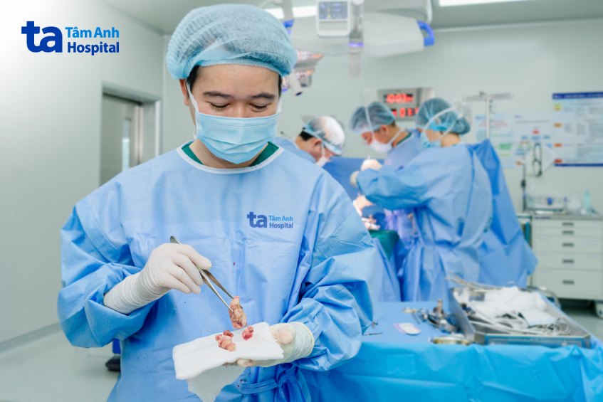 sỏi san hô được đưa ra khỏi cơ thể