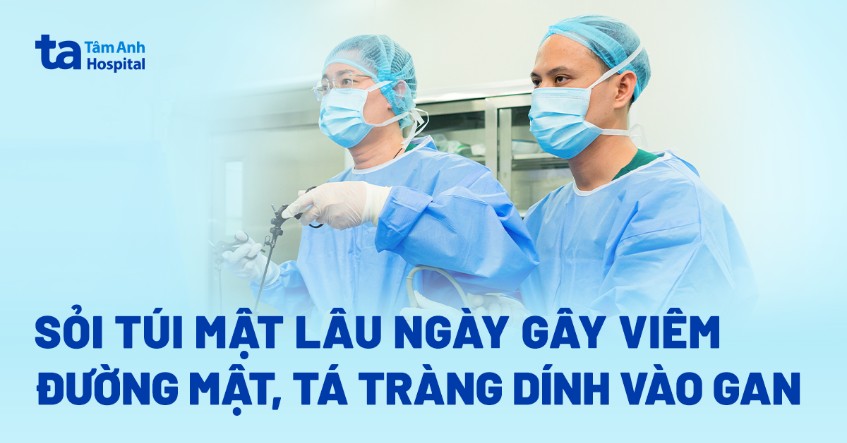 Sỏi túi mật lâu ngày biến chứng viêm dính