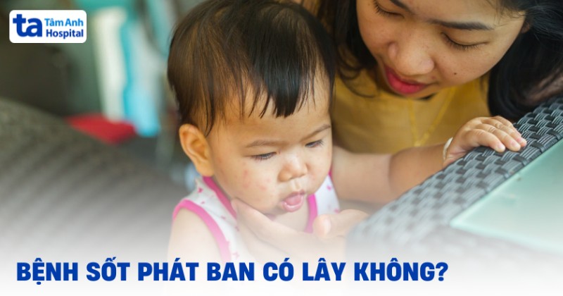 Sốt phát ban có lây không? Lây ở giai đoạn nào? Cách phòng ngừa