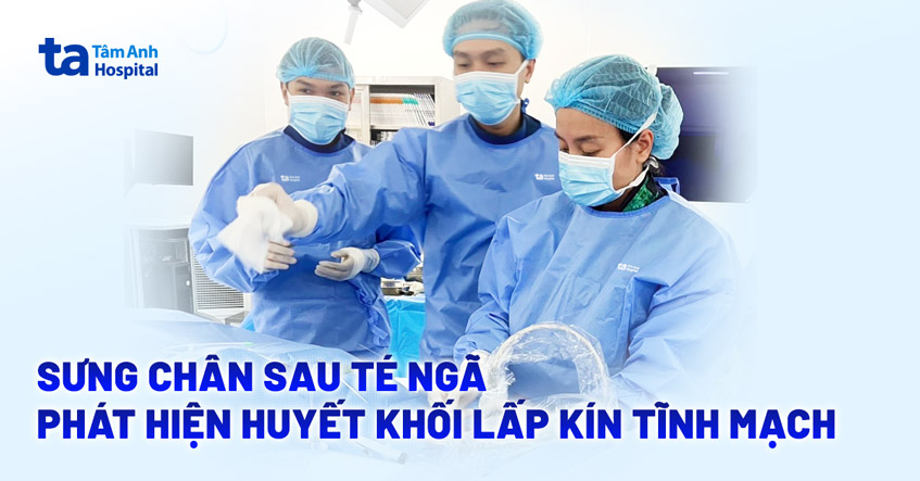 Sưng chân sau té ngã phát hiện huyết khối lấp kín tĩnh mạch