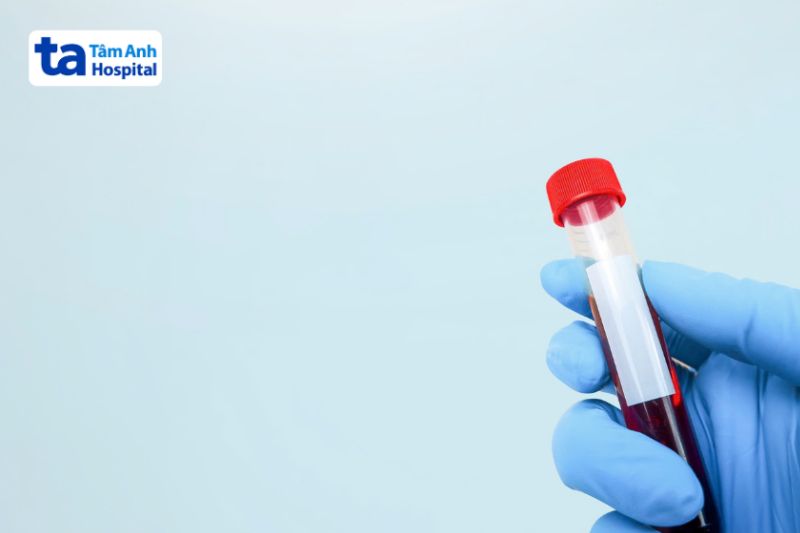 xét nghiệm máu chẩn đoán suy giảm miễn dịch mắc phải