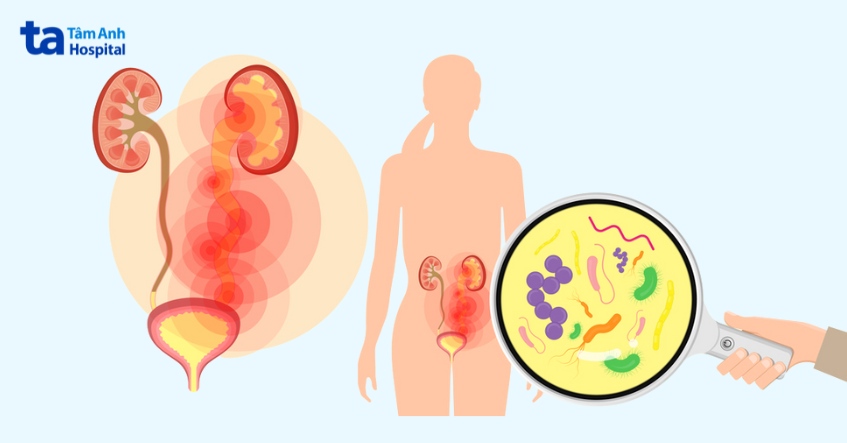 tại sao bị tiểu rắt sau khi quan hệ
