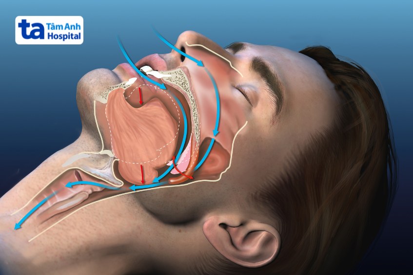 tần suất ngưng thở khi ngủ và thức giấc trong đêm