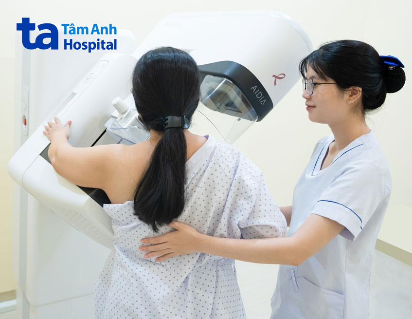 tăng tỷ lệ phát hiện ung thư vú xâm lấn