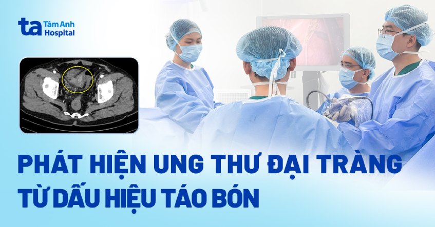 táo bón gây ung thư đại tràng