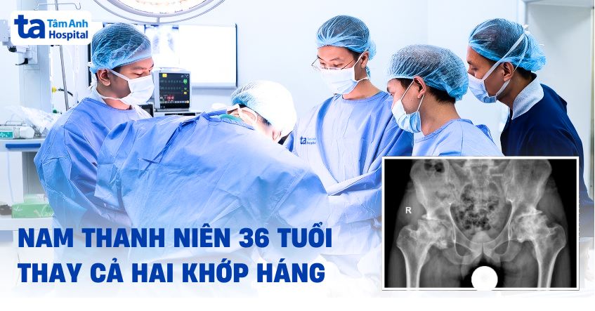 thanh niên 36 tuổi thay cả hai khớp háng