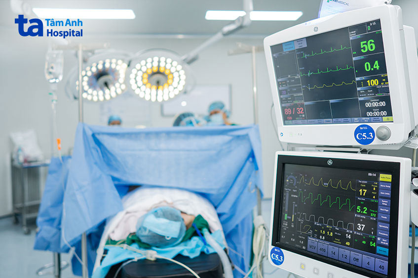 theo dõi chỉ số sinh tồn trong ca mổ