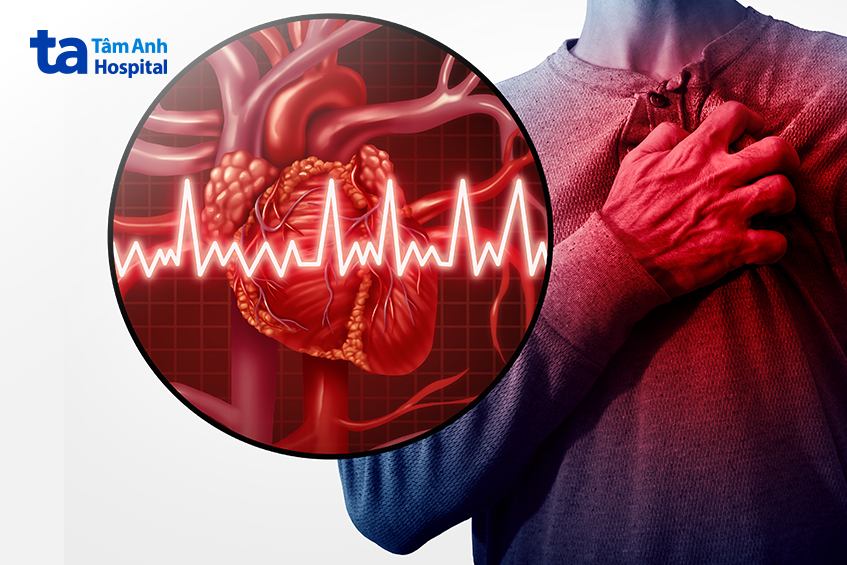 thiếu máu thiếu sắt gây tim đập nhanh