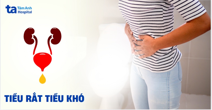 tiểu rắt tiểu khó