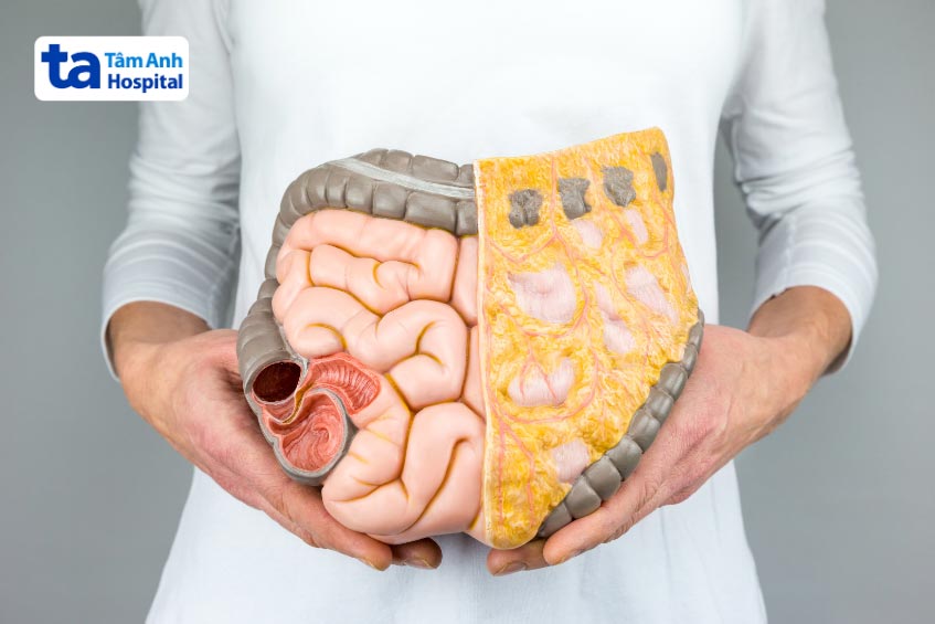 tình trạng mô ruột bị chết