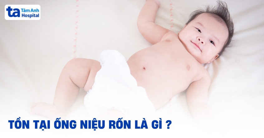 tồn tại ống niệu rốn